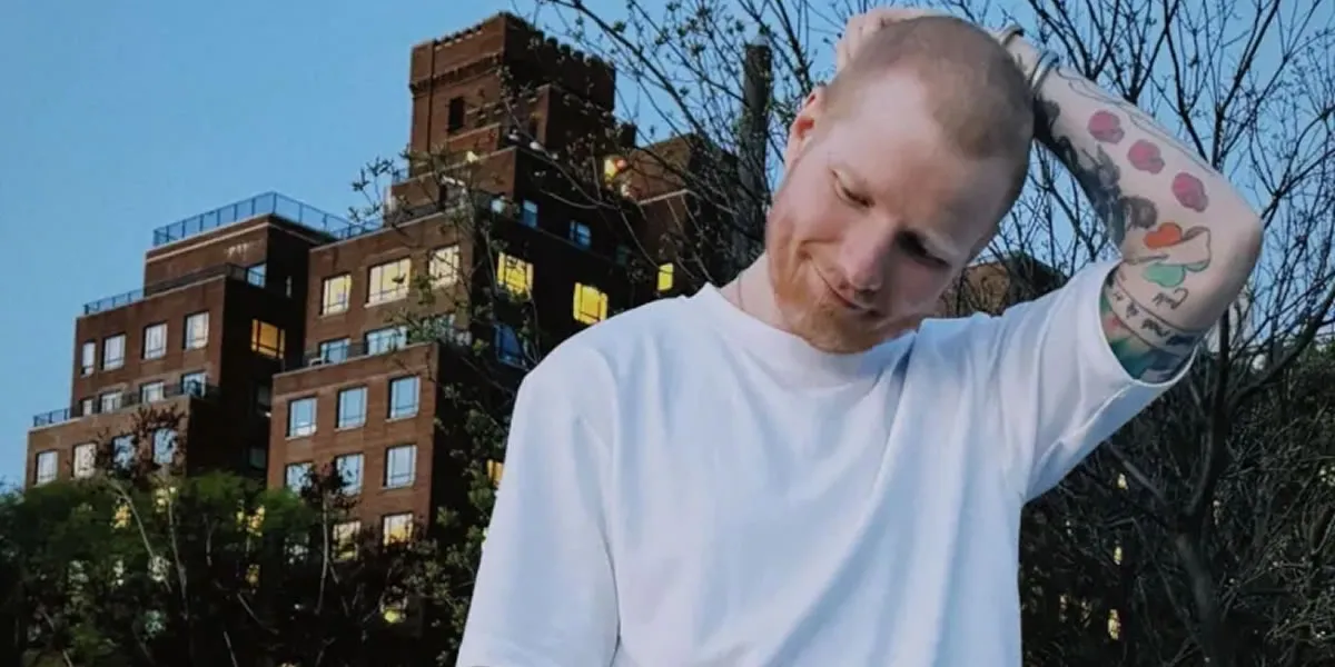 ed_sheeran_hair_transformation